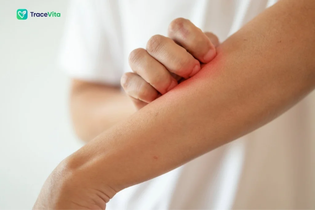 Common Signs of Dry Skin
