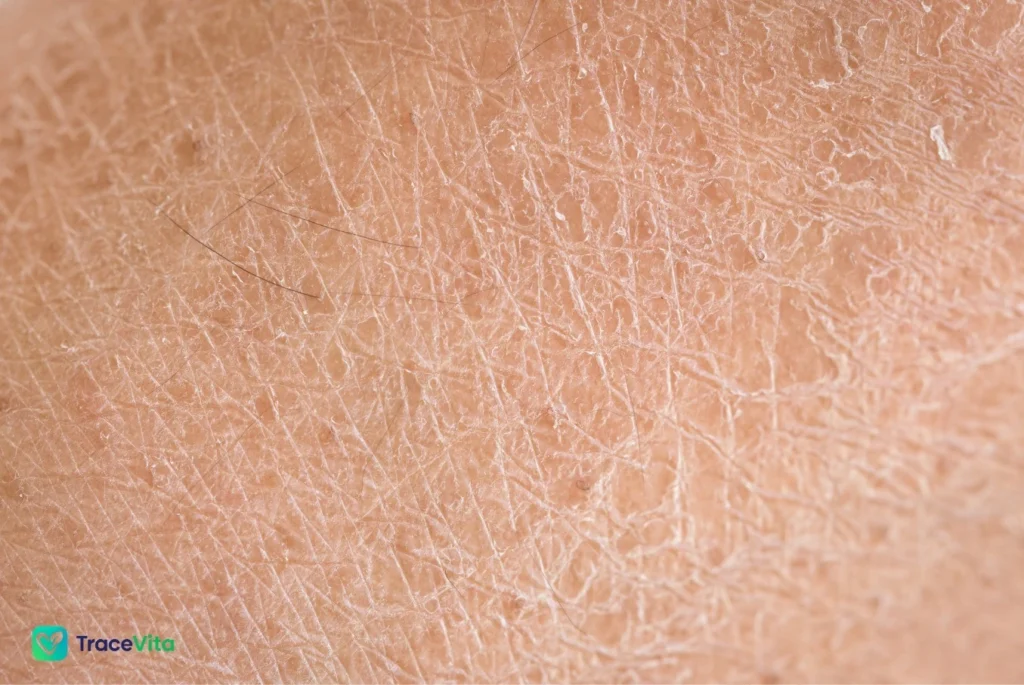 When to See a Doctor for Dry Skin